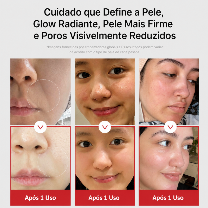 Booster Pro Aparelho Facial Coreano Multifuncional