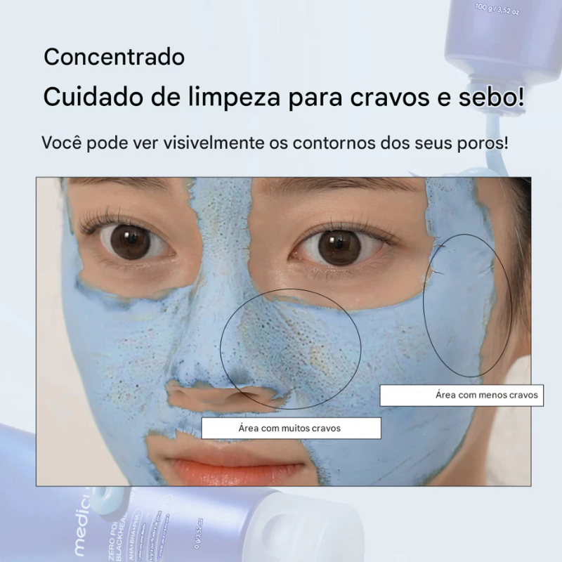 Medicube Zero Pore Blackhead Mud Mask – Máscara Purificante para Cravos e Poros