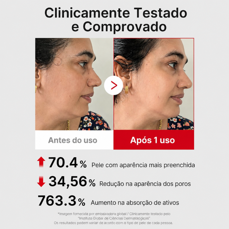 Booster Pro Aparelho Facial Coreano Multifuncional